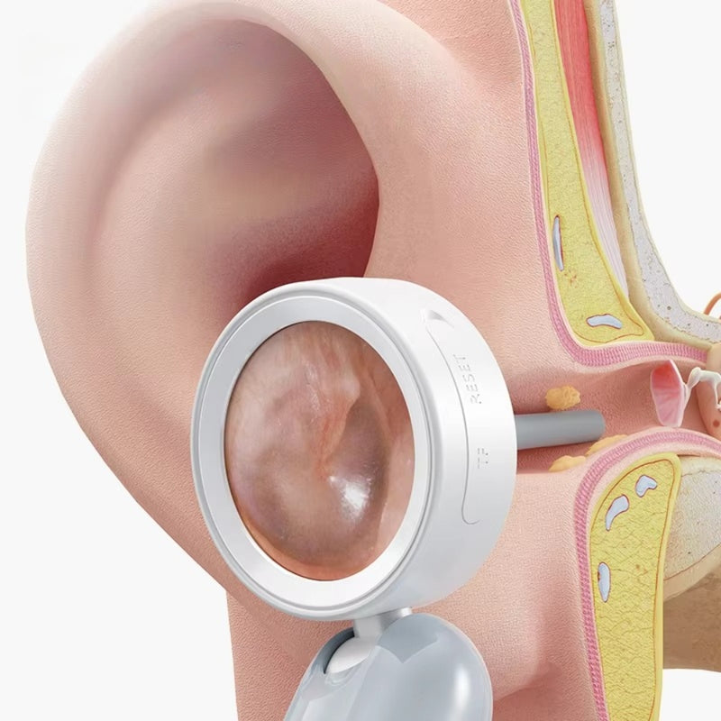 Portable 1080P Ear Scope with 12 Replaceable Tips