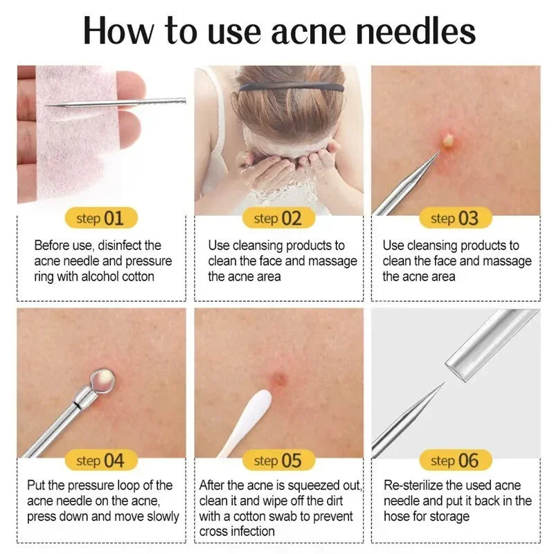 11pcs Acne Pimples Blackhead Remover Clip Facial Cleaner