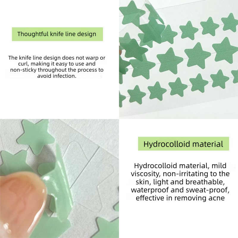 Star Acne Patches Blue 5 Sheets - 40 Stars Per Sheet, Hydrocolloid Blemish Stickers, Waterproof Sweat-Resistant Star Pimple Covers